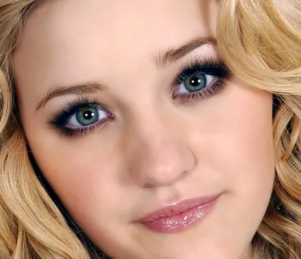 自体骨隆鼻价格