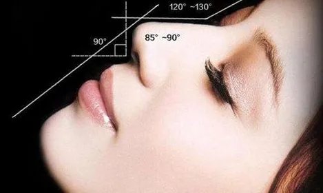 朝天鼻矫正哪好