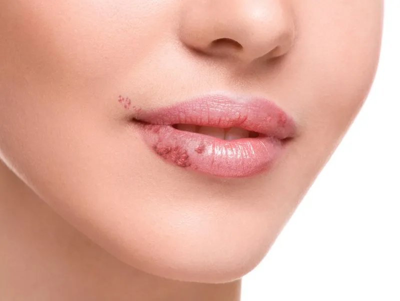 嘴唇上有小白点怎么回事