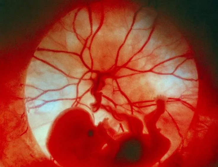 怀孕三个月是什么样子