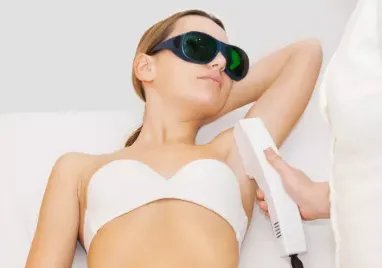 用激光脱毛好吗