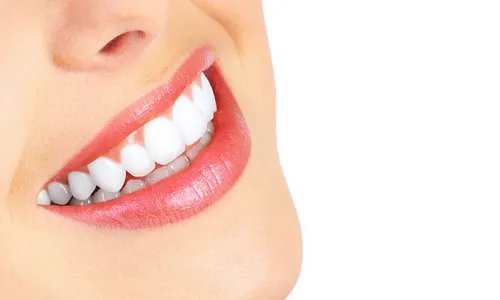 洗牙结石多少钱