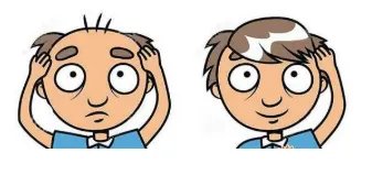 fue植发的价格一般是多少