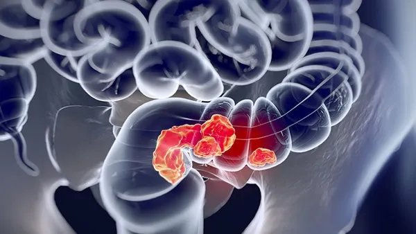 食物过敏的症状