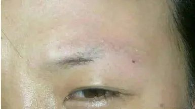 洗纹眉的坏处