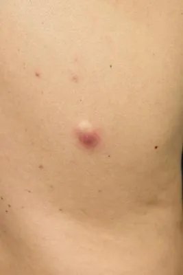 清热解毒的中药材有哪些