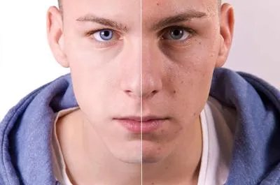 什么方法可以快速美白皮肤