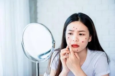 怎么快速祛痘印