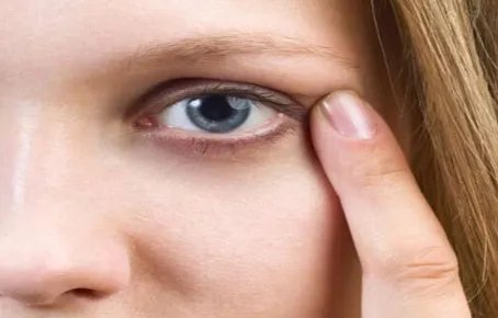 自体脂肪填充眼窝注意什么