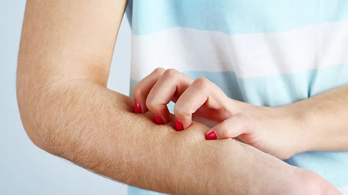 皮肤过敏瘙痒怎么办