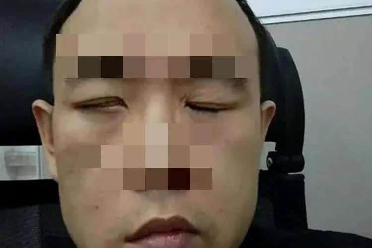 掉线风病症状图片