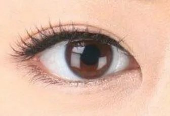 杭州一般做双眼皮多少钱