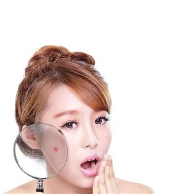 青春痘治疗医院治疗青春痘