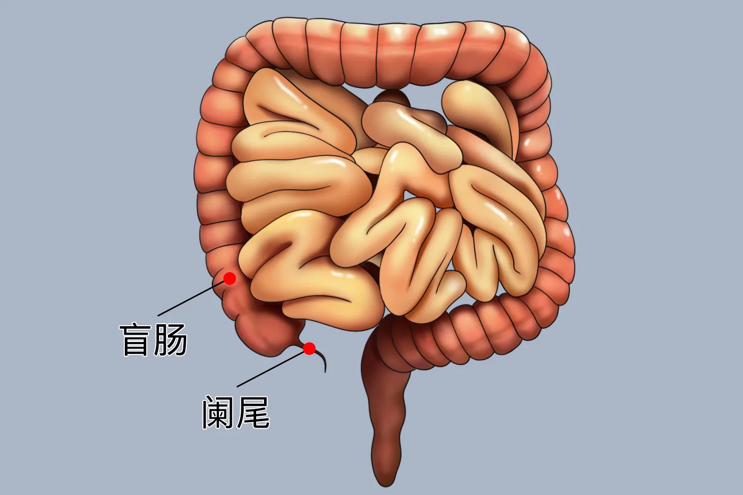 阑尾长在什么位置图解