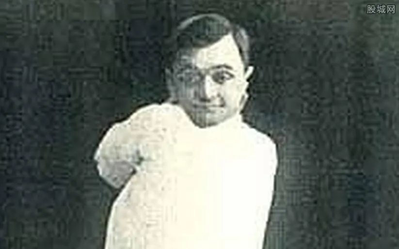 人类历史上九大怪胎四腿女人和独角兽 吓死人不偿命