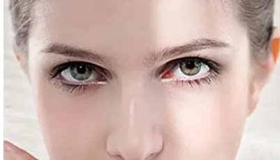 眼部整形手术价格大概要多少钱