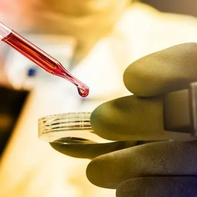 割肾会出现什么症状