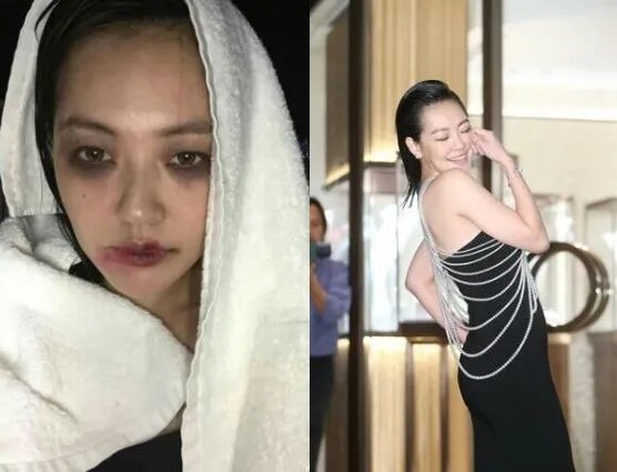 揭秘小s满脸淤青出镜内幕  网友感叹幸亏不是家暴