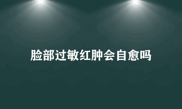 脸部过敏红肿会自愈吗