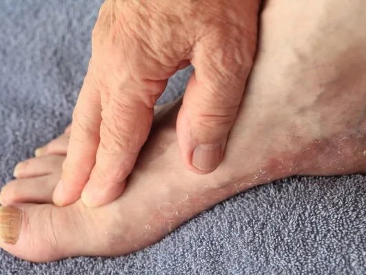 哪些原因会出现手脚肿胀