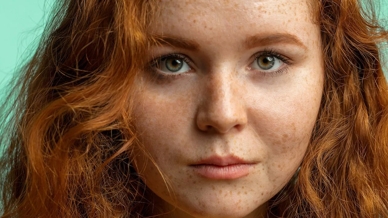 脸上的色斑是怎么形成的