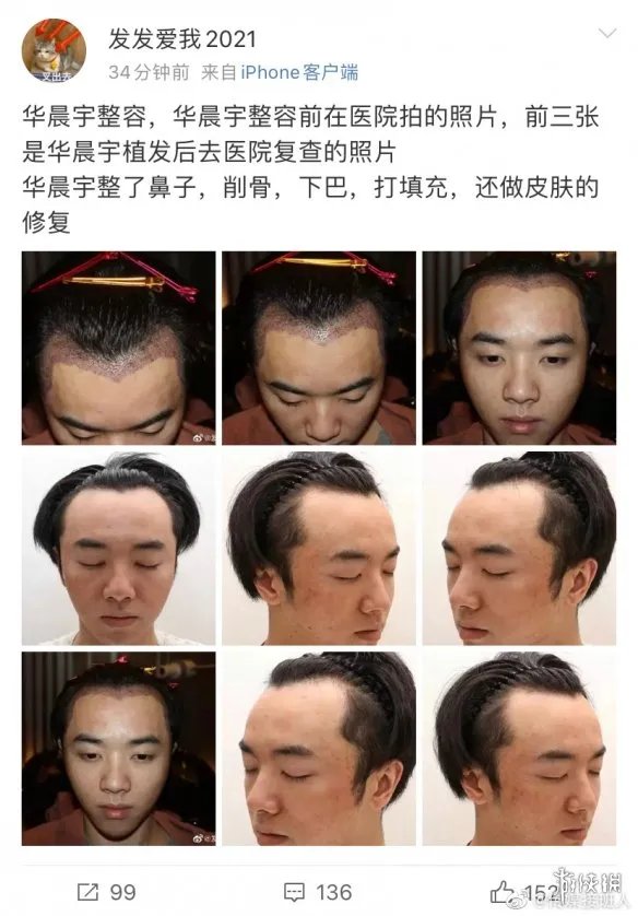 发发爱我2021华晨宇是什么梗 发发爱我2021爆料华晨宇整容