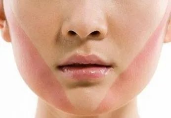 削骨手术多少钱