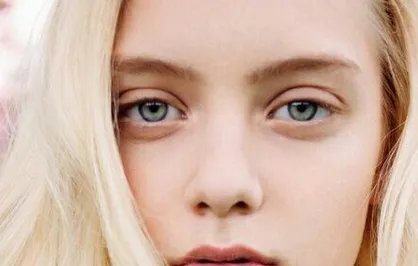 玻尿酸隆鼻能保持多久呢