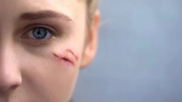 女人右眼皮跳是吉是凶怎么化解