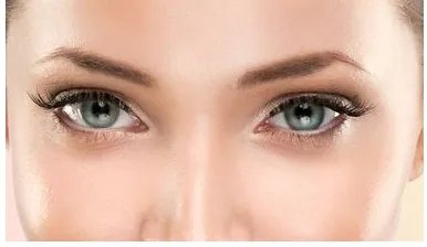 眼部微整形后注意事项