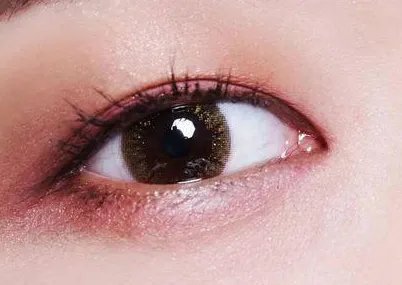 双眼皮微创的好处