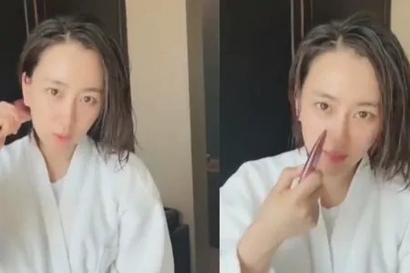 马苏眉毛脱落 如此状态令人担忧