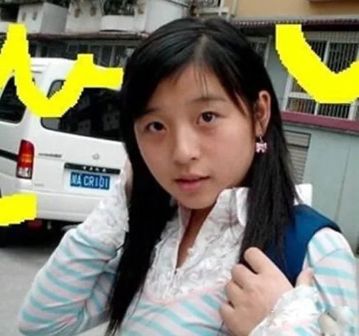 张含韵整容照片遭曝光  样貌吓人惊呆众网友