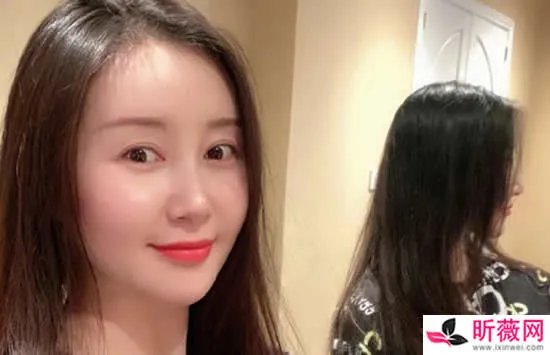 舒畅演过的电视剧大全 这几部相信你一定看过