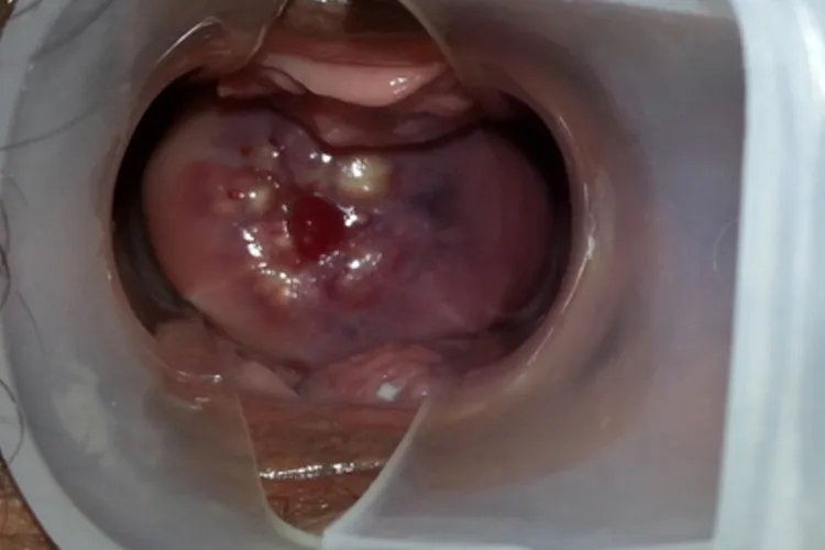 什么是纳囊的图片大全