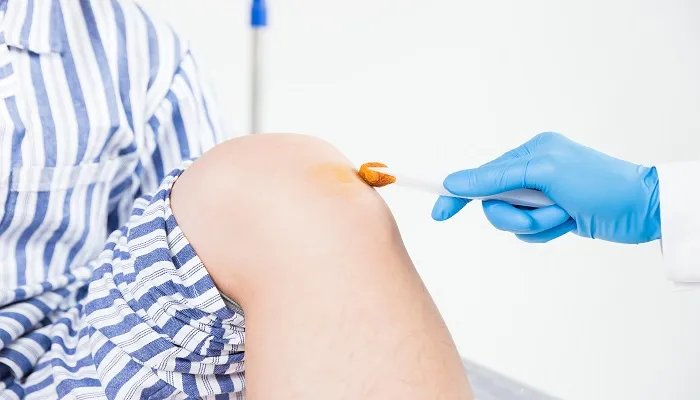 碘酒的溶剂是什么