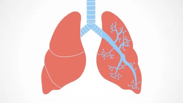 COPD应该如何预防