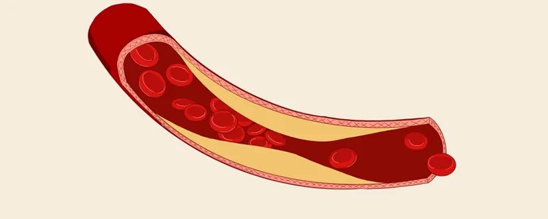 血液透析并发症如何处理