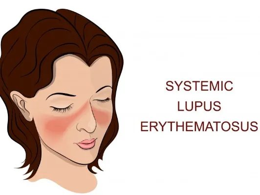 褐青色斑的形成原因