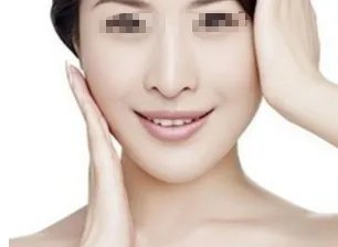 什么胶原蛋白效果好