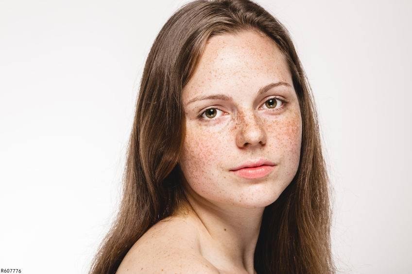 祛斑的最好方法是什么