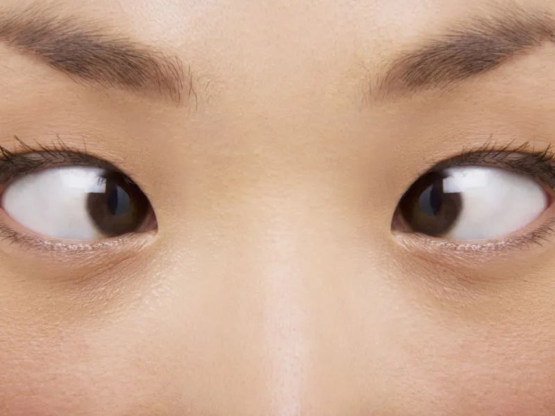 脚鸡眼是怎么形成的