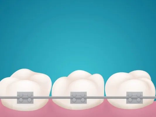 肥大性龈炎的症状