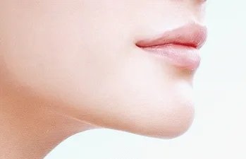 下巴整形价格