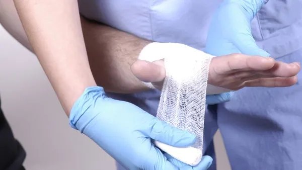 手脱皮是什么原因导致的？手脱皮用什么药效果最好？