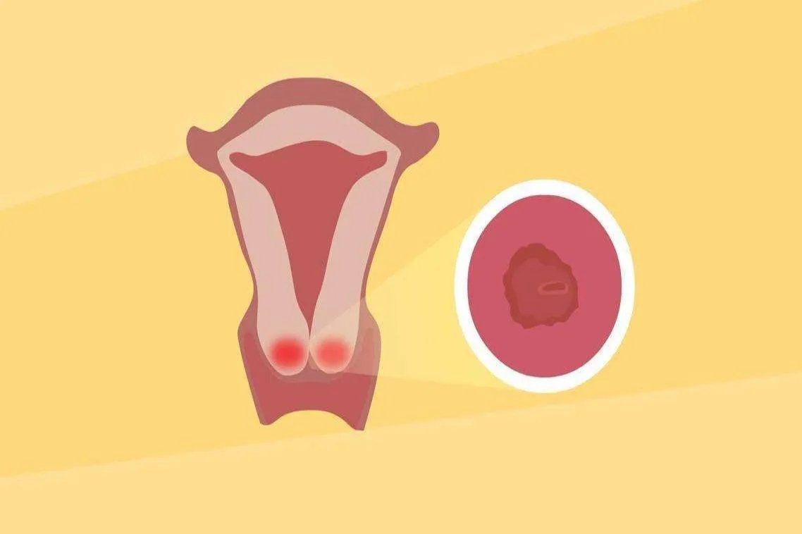 用康美丹排出糜烂的图片