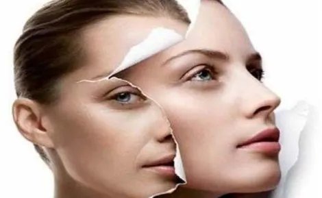 北京玻尿酸手术费用如何