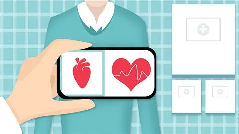 心脏支架手术后寿命