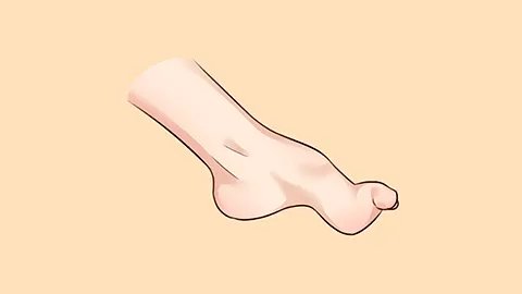 脊髓灰质炎活疫苗糖丸的副作用