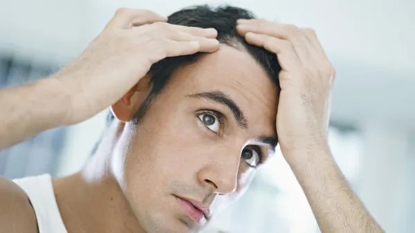 治疗脱发的最好方法